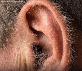What Your Ear Hair Says About Your Health