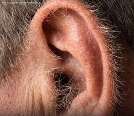 What Your Ear Hair Says About Your Health