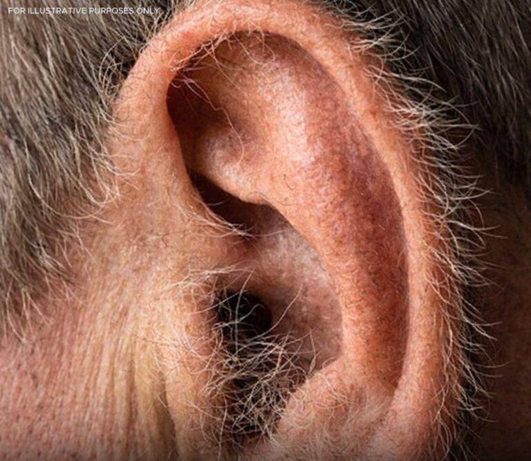 What Your Ear Hair Says About Your Health