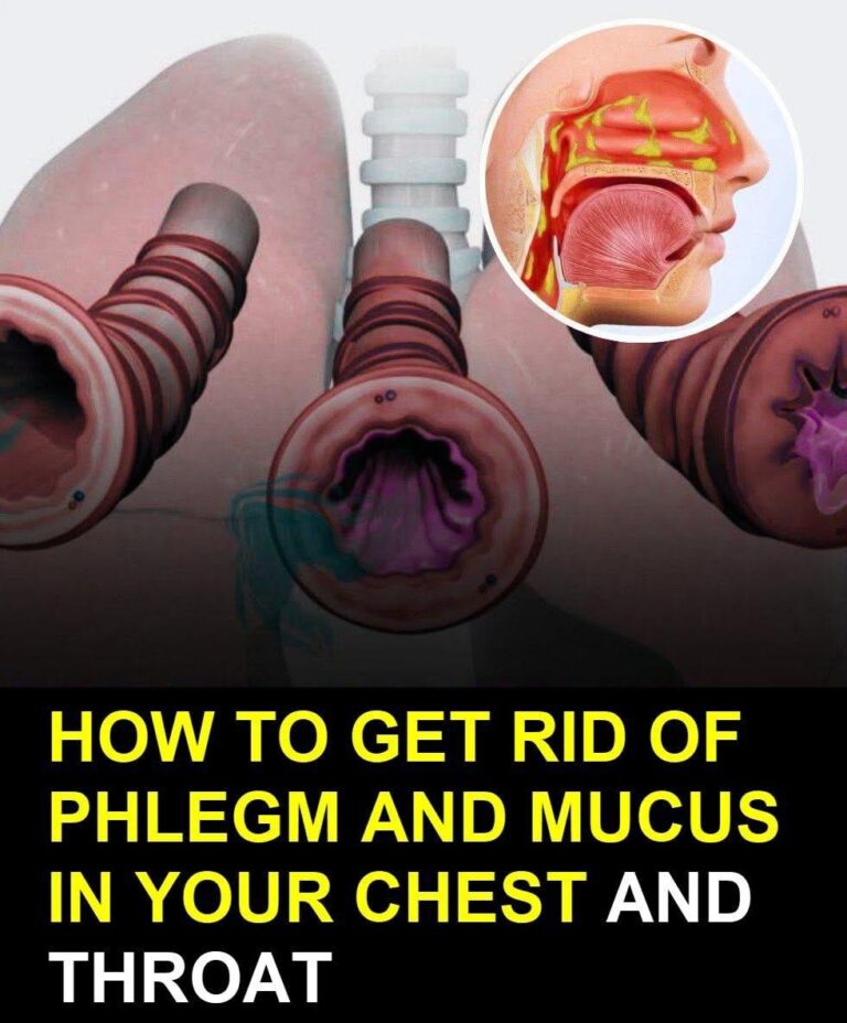 How to Naturally Clear Phlegm and Mucus from Chest and Throat