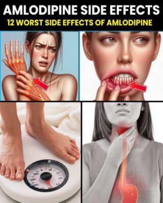 12 Worst Side Effects of Amlodipine You Should NEVER Ignore!