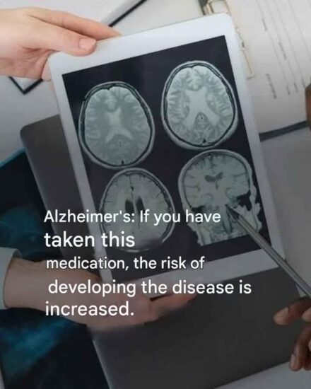 Alzheimer’s: These 6 Habits Increase the Risk Without You Knowing It