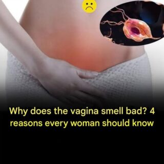 Why does the vagina smell bad? 4 reasons every woman should know